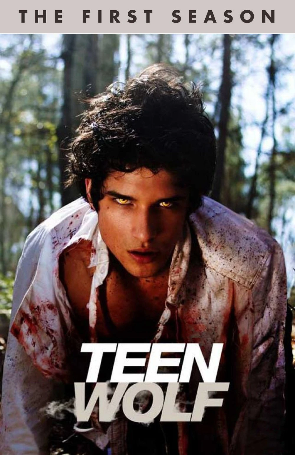 Người Sói Tuổi Teen (Phần 1) - Teen Wolf (Season 1)